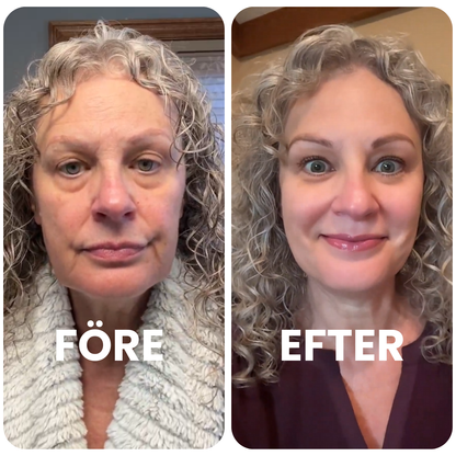 Før og etter bilde av kvinne med klarere hud og mer glød etter bruk.