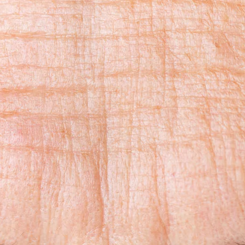 RYNKER & FINE LINJER